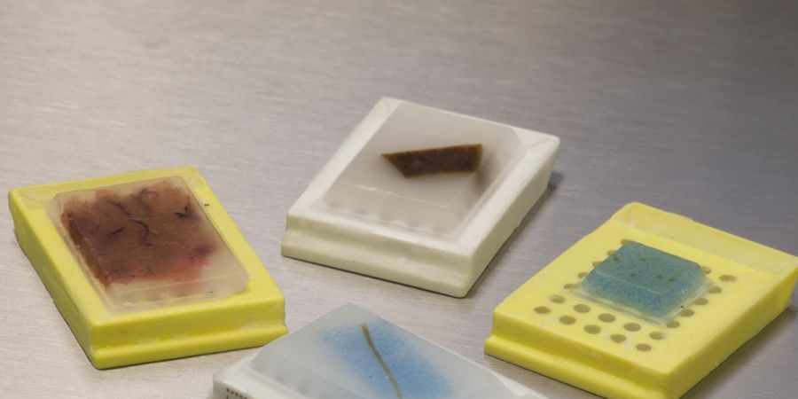 Paraffin Tissue Block